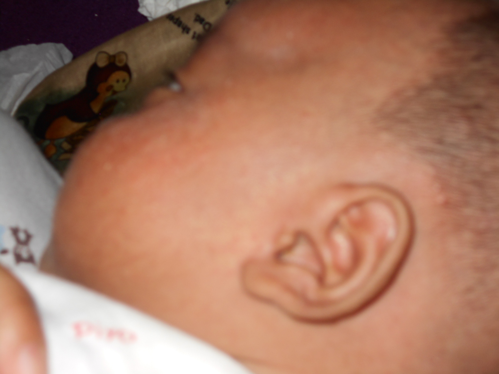 Telinga kiri Ahmad Azzam Halimi yang berbentuk lafadz Allah itu...